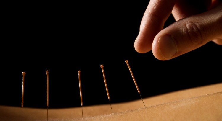 ¿Debería un cristiano participar en la acupuntura o acupresión?